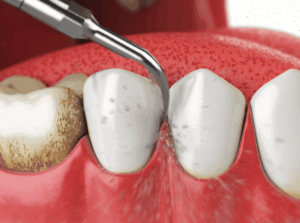 화면 캡처 2025-11-26 221808