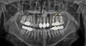 화면 캡처 2025-11-29 231754