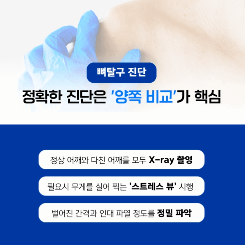 쇄골 통증