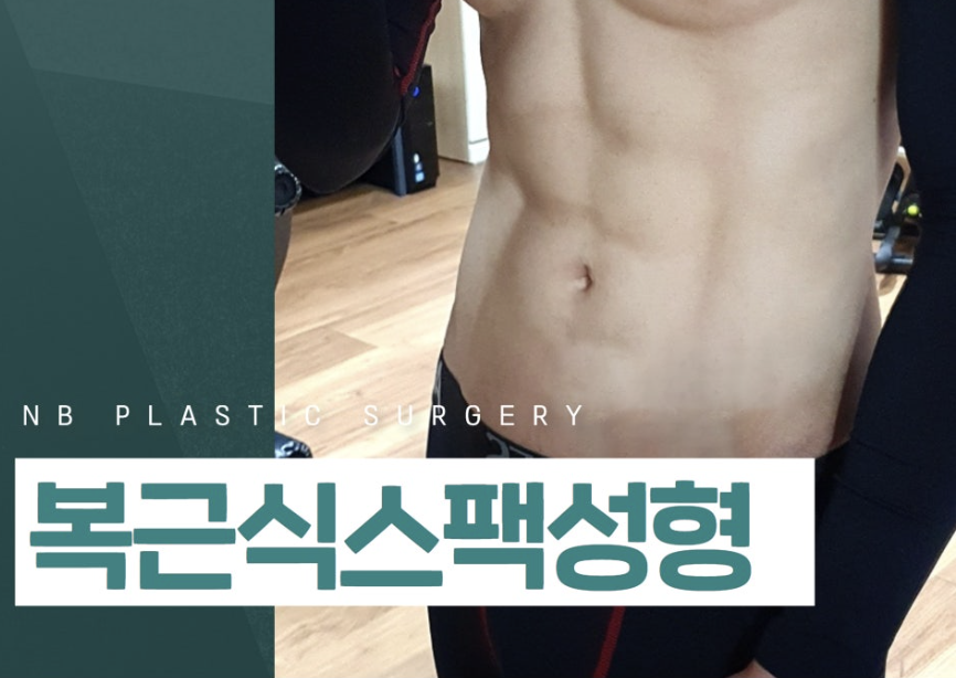복근성형