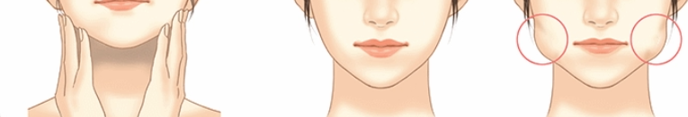 사각턱보톡스 효과