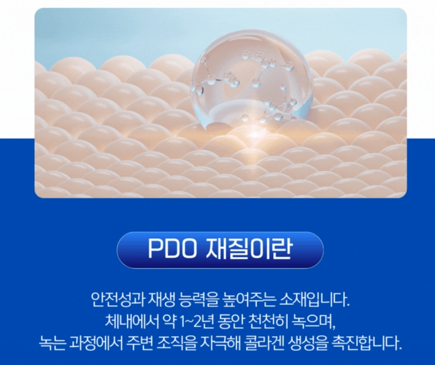 실리프팅 유지기간