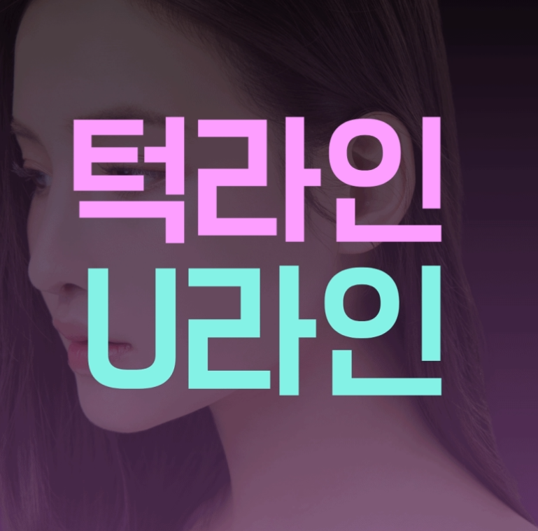 사각턱보톡스 효과