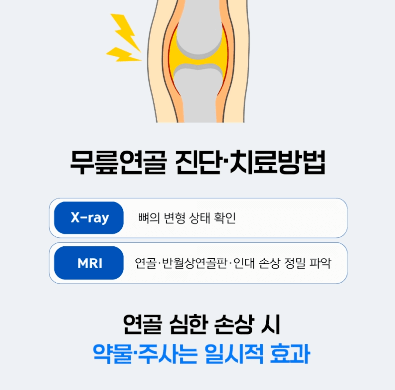 무릎카티스템