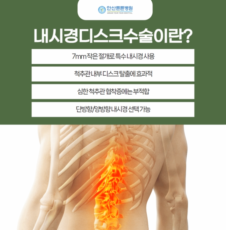디스크수술