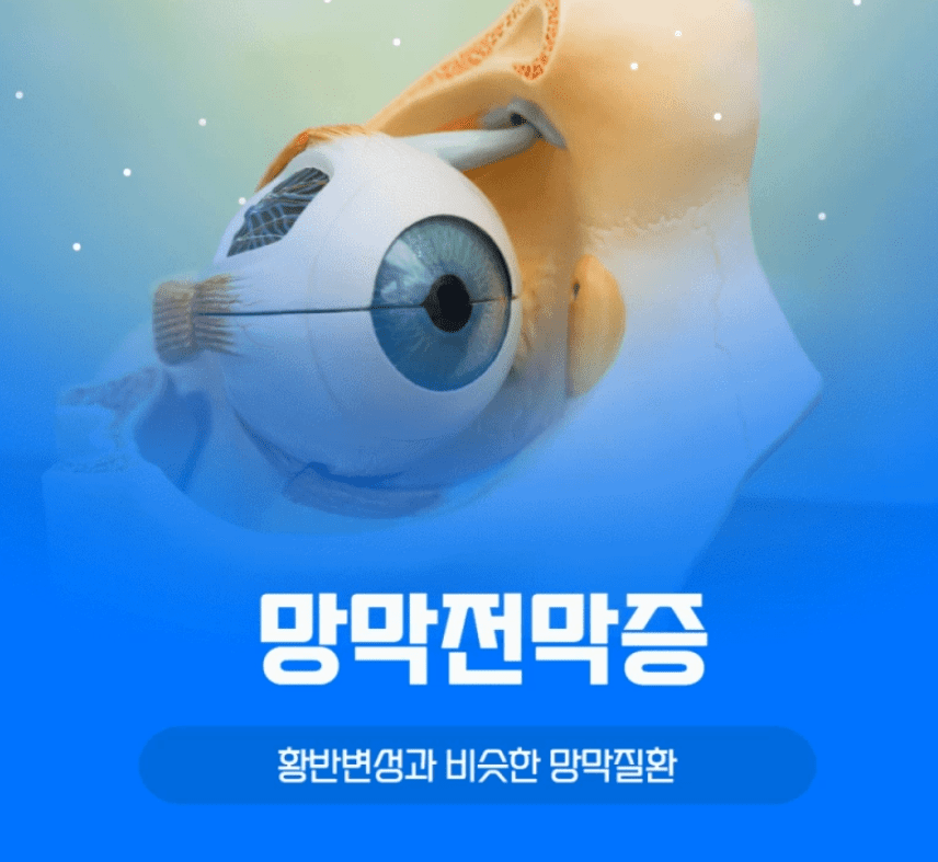 망막전막증증상