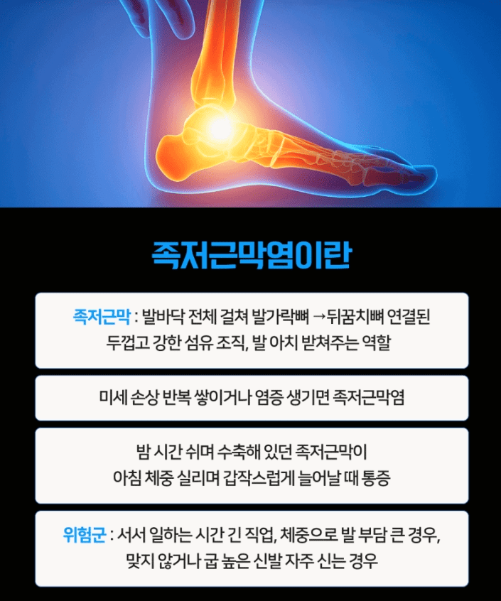 족저근막염 증상
