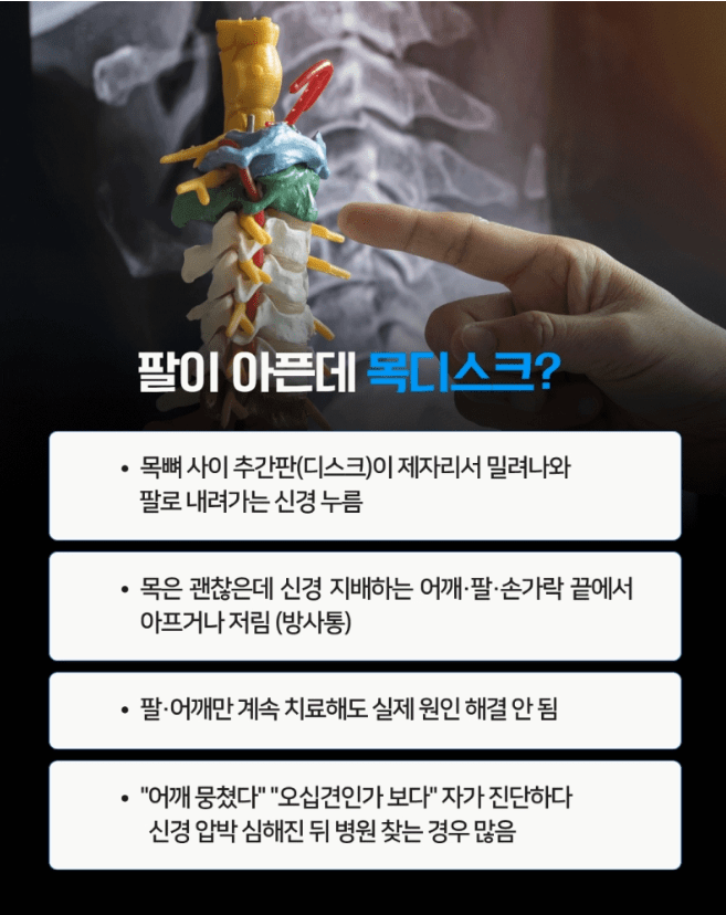 목디스크증상