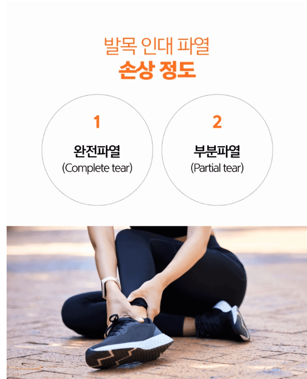 발목인대끊어짐