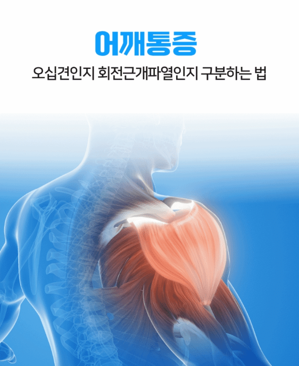 오십견 치료방법