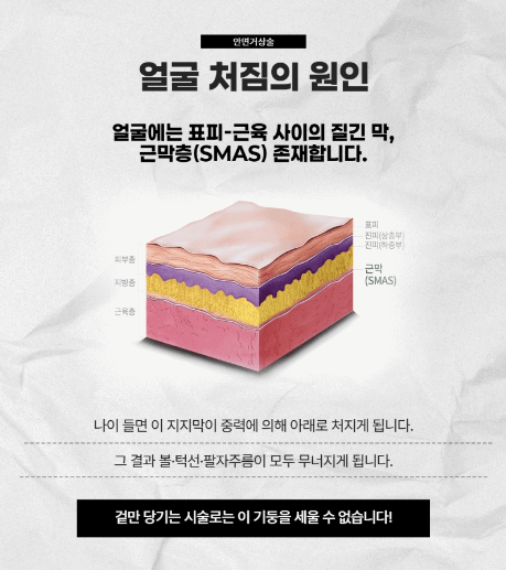 안면거상술 효과
