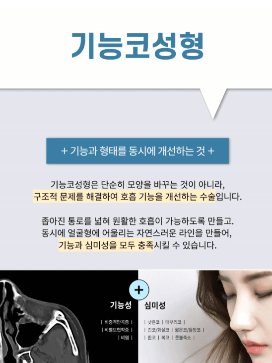 기능성코성형가격
