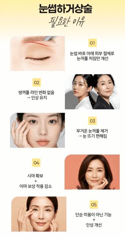 눈썹하거상술 비용