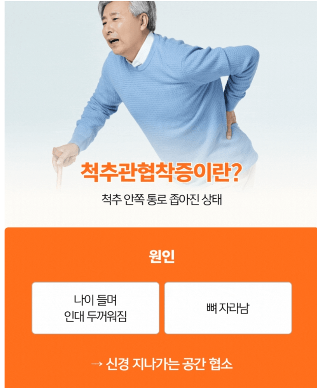 척추관협착증 치료