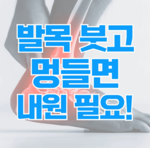 발목인대파열