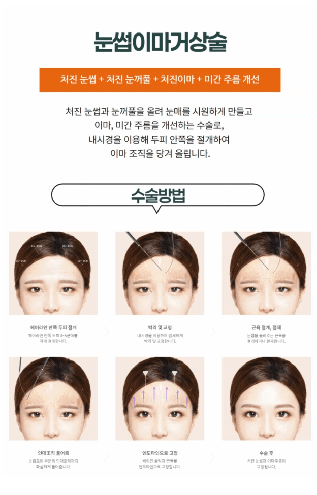 눈썹이마거상술