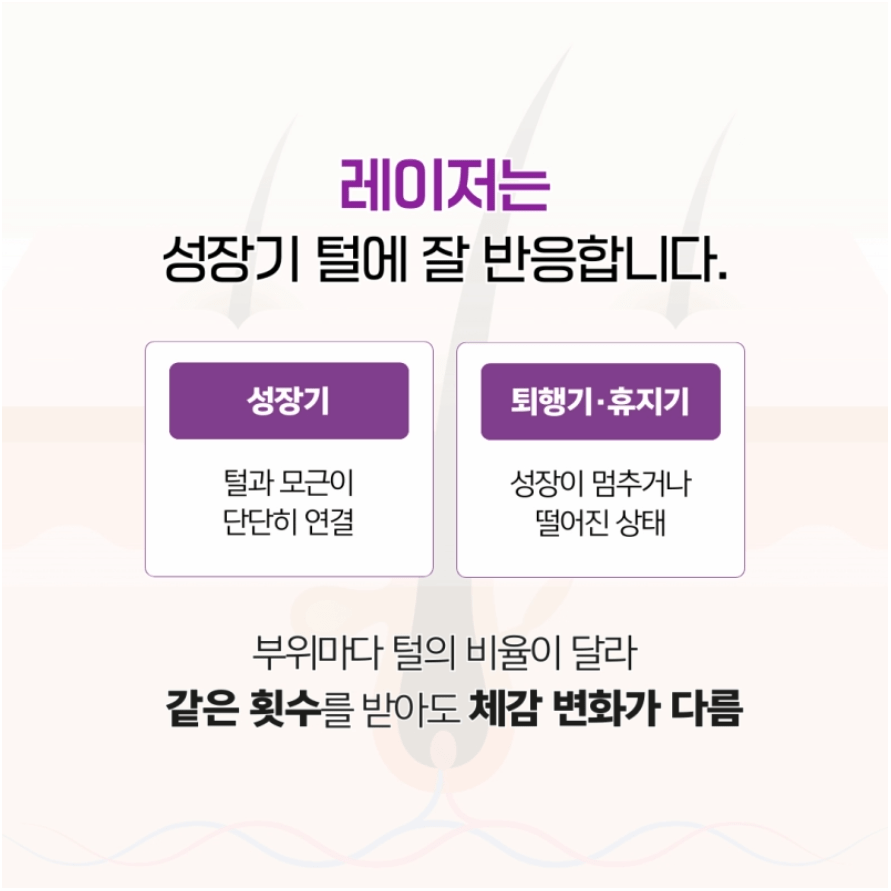 레이저제모
