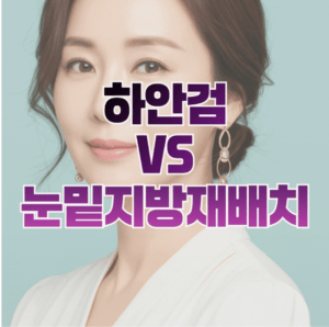 하안검눈밑지방재배치