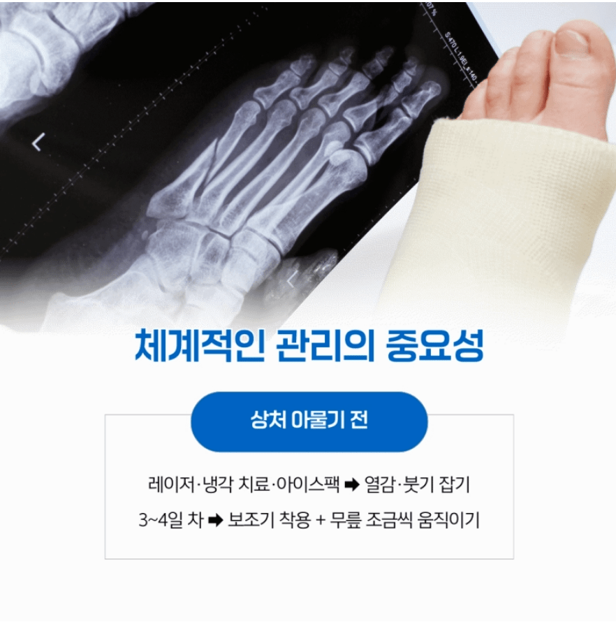 전방십자인대 재건술