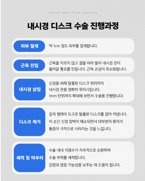 안산허리디스크수술
