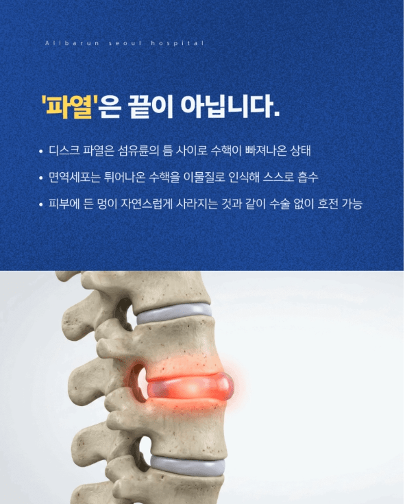 천호동 허리디스크