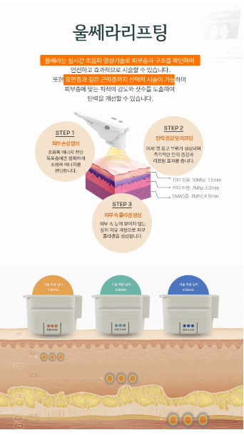 울쎄라리프팅질하는곳