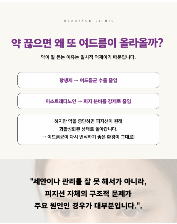 피부과여드름치료