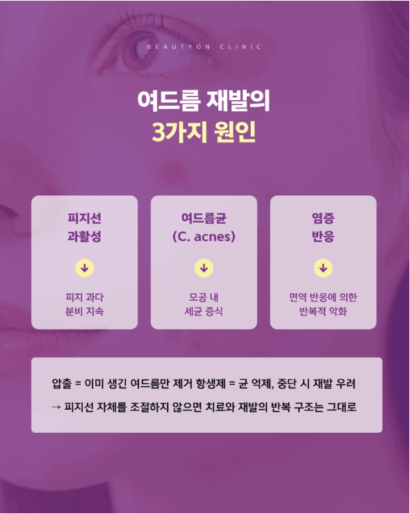 평택여드름피부과